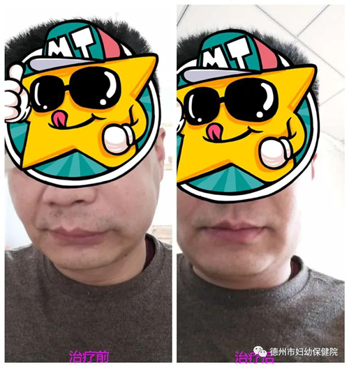 圖片1.png